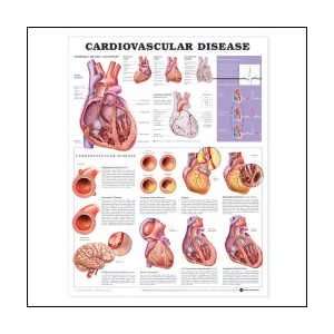 Cardiovascular Disease Anatomical Chart 20 X 26