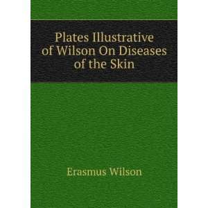   Illustrative of Wilson On Diseases of the Skin Erasmus Wilson Books