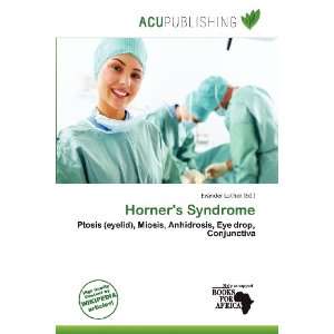  Horners Syndrome (9786200850362) Evander Luther Books