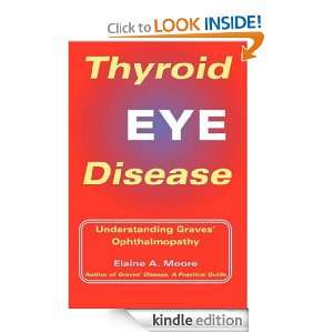 Thyroid Eye Disease: Understanding Graves Ophthalmopathy: Elaine A 
