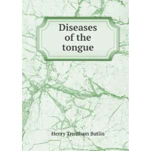  Diseases of the tongue Henry Trentham Butlin Books
